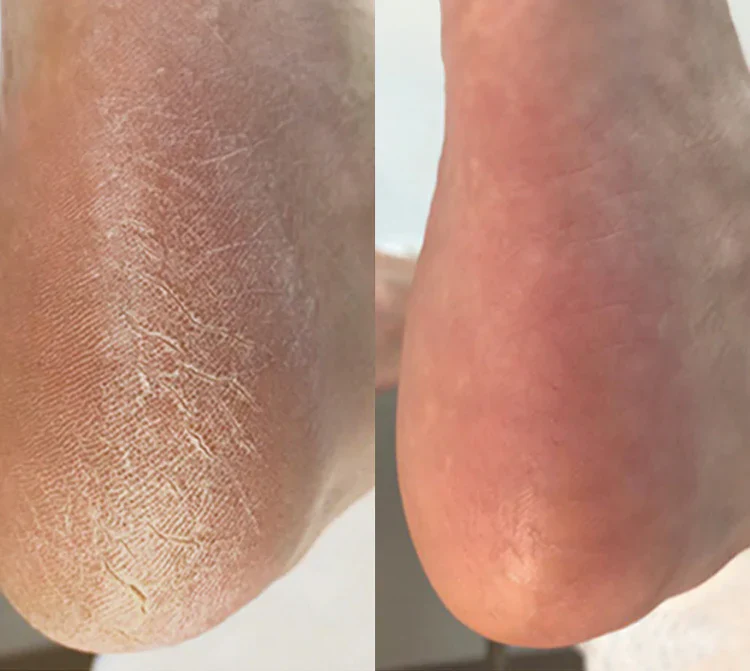 <p><strong>Echte Menschen. Beeindruckende Ergebnisse.</strong></p>