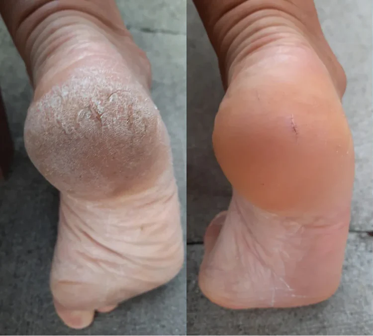 <p><strong>Echte Menschen. Beeindruckende Ergebnisse.</strong></p>